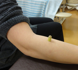 お灸